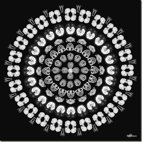 Mandala contemporain avec imagerie médicale-MANDALA pensee-helene goddyn-www.wonderful-art.fr