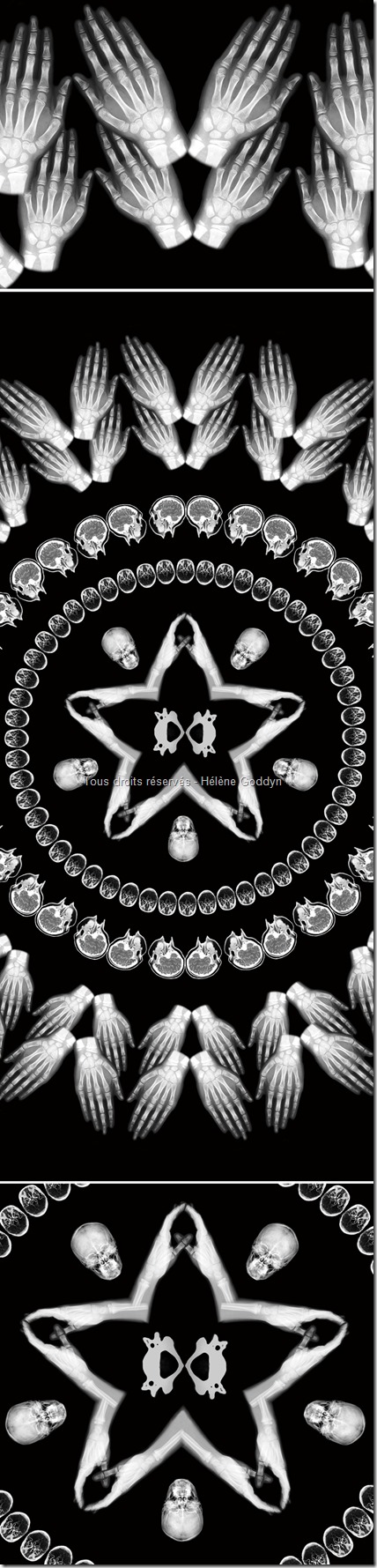 mandala_vision_image medicale_echographies foetus_helene goddyn_wonderful art_www.wonderful-art.fr